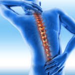 Ankylosing Spondylitis