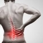 Spinal Injuries